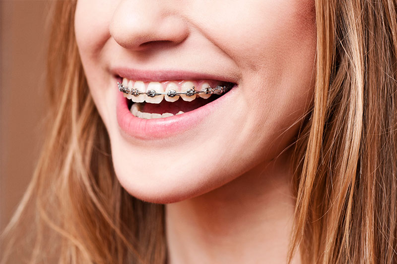 Orthodontics in Harrogate